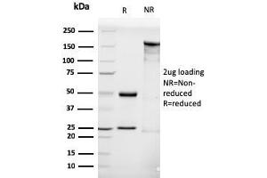 SDS-PAGE Analysis Purified LHCGR Mouse Monoclonal Antibody (LHCGR/1416). (LHCGR 抗体  (AA 70-410))