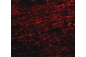 Immunofluorescence staining of human brain tissue with 20 ug/mL CLIP1 polyclonal antibody . (CLIP1 抗体  (C-Term))
