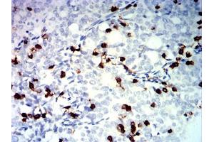 Immunohistochemistry (IHC) image for anti-Tumor Necrosis Factor Receptor Superfamily, Member 25 (TNFRSF25) antibody (ABIN7193676)