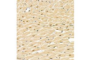 Immunohistochemistry of paraffin embedded rat heart using SMNDC1 (ABIN7075773) at dilution of 1:1000 (400x lens) (SMNDC1 抗体)