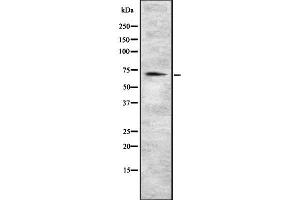 Western blot analysis of EOMES using HuvEc whole cell lysates (EOMES 抗体  (C-Term))