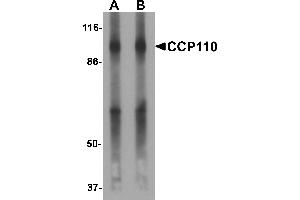 Western blot analysis of CCP110 in human colon tissue lysate with CCP110 antibody at (A) 1 and (B) 2 µg/mL. (CP110 抗体  (C-Term))
