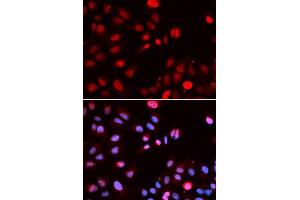Immunofluorescence analysis of U2OS cells using MPG antibody. (MPG 抗体  (AA 1-293))