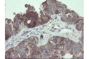 Image no. 15 for anti-TSC22 Domain Family, Member 1 (TSC22D1) antibody (ABIN1501540)