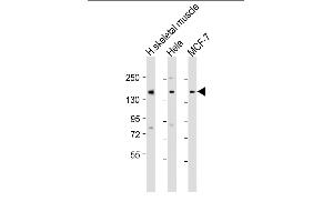All lanes : Anti-TNRC6A Antibody (Center) at 1:1000-1:2000 dilution Lane 1: human skeletal muscle lysate Lane 2: Hela whole cell lysate Lane 3: MCF-7 whole cell lysate Lysates/proteins at 20 μg per lane. (TNRC6A 抗体  (AA 855-885))