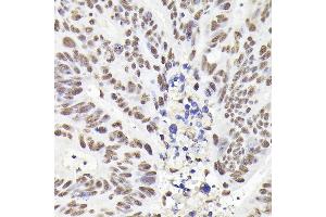 Immunohistochemistry (IHC) image for anti-RAD21 Homolog (RAD21) antibody (ABIN7269822)