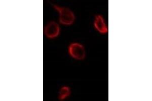 ABIN6276697 staining HuvEc by IF/ICC. (TIMP3 抗体  (Internal Region))