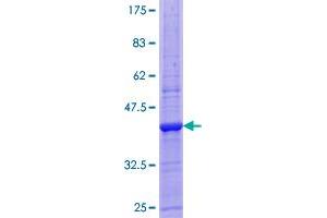 Image no. 1 for Activated Leukocyte Cell Adhesion Molecule (ALCAM) (AA 1-133) protein (GST tag) (ABIN1344804)