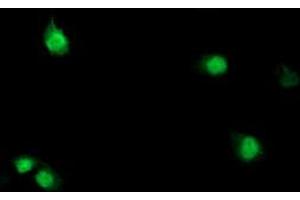 Anti-SDS mouse monoclonal antibody (ABIN2455307) immunofluorescent staining of COS7 cells transiently transfected by pCMV6-ENTRY SDS (RC217814). (serine Dehydratase 抗体)