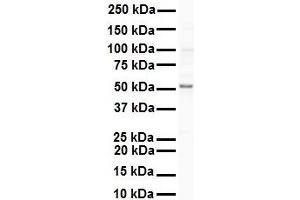 WB Suggested Anti-SNRP70 antibody Titration: 1 ug/mL Sample Type: Human Raji (SNRNP70 抗体  (N-Term))