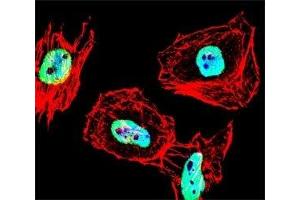 Fluorescent confocal image of HeLa cell stained with HDAC antibody at 1:25.
