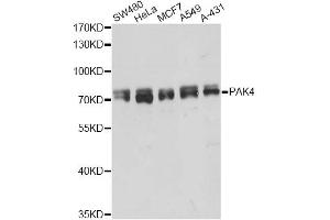 Western blot analysis of extracts of various cell lines, using PAK4 antibody (ABIN5998444) at 1/5000 dilution. (PAK4 抗体)