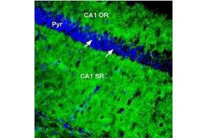 Immunohistochemistry (IHC) image for anti-ATPase, Ca++ Transporting, Plasma Membrane 1 (ATP2B1) (AA 12-24), (Intracellular) antibody (ABIN7042955)