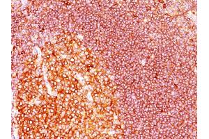 Formalin-fixed, paraffin-embedded human Tonsil stained with MALT1 Mouse Monoclonal Antibody (MT1/410). (MALT1 抗体  (AA 701-808))
