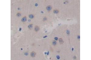 IHC-P analysis of brain tissue, with DAB staining. (Glutaminase 抗体  (AA 31-253))