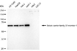 Western blotting analysis using solute carrier family 22 member 1 antibody (ABIN7800389).