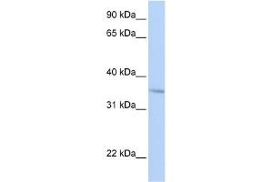 WB Suggested Anti-FHL3 Antibody Titration:  0. (FHL3 抗体  (Middle Region))