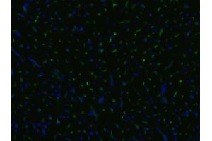 Immunofluorescence staining of an infarcted porcine heart with anti-CD105 (MEM-229 ; (Endoglin 抗体)