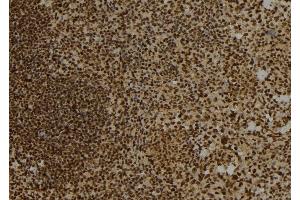ABIN6276780 at 1/100 staining Mouse spleen tissue by IHC-P. (DTNBP1 抗体  (C-Term))