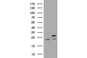 Image no. 3 for anti-NADH Dehydrogenase (Ubiquinone) 1 beta Subcomplex, 10, 22kDa (NDUFB10) antibody (ABIN1499673)
