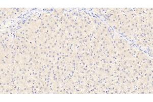 Detection of ALB in Human Liver Tissue using Monoclonal Antibody to Albumin (ALB) (Albumin 抗体)