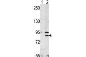 Western Blotting (WB) image for anti-Bromodomain Containing 2 (BRD2) antibody (ABIN3003651) (BRD2 抗体)