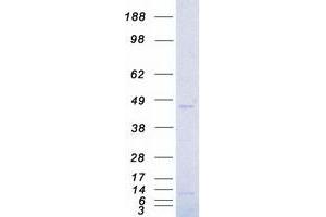 Western Blotting (WB) image for Aurora Kinase A (AURKA) (Transcript Variant 1) protein (Myc-DYKDDDDK Tag) (ABIN2715082)