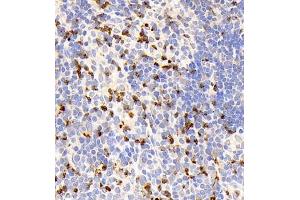 Immunohistochemistry (Paraffin-embedded Sections) (IHC (p)) image for anti-CD177 Molecule (CD177) antibody (ABIN7073372)