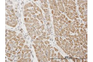 Immunoperoxidase of monoclonal antibody to TNNI3 on formalin-fixed paraffin-embedded human heart. (TNNI3 抗体  (AA 102-210))