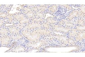 Detection of ALOX15 in Human Kidney Tissue using Monoclonal Antibody to Arachidonate-15-Lipoxygenase (ALOX15) (ALOX15 抗体  (AA 170-312))