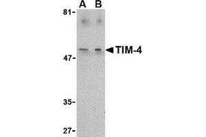 Western blot analysis of TIM-4 in Jurkat lysate with this product at (A) 1 and (B) 2 μg/ml. (TIMD4 抗体  (C-Term))