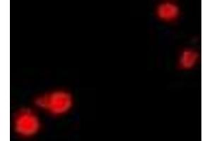 Immunofluorescent analysis of CTNNBL1 staining in U2OS cells. (CTNNBL1 抗体)