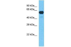 Western Blotting (WB) image for anti-Cytochrome P450, Family 2, Subfamily E, Polypeptide 1 (CYP2E1) (C-Term) antibody (ABIN2776801)