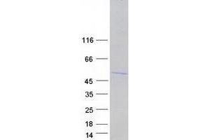 Validation with Western Blot