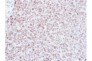 Immunohistochemistry (IHC) image for anti-MAD2 Mitotic Arrest Deficient-Like 1 (Yeast) (MAD2L1) (C-Term) antibody (ABIN2855897)