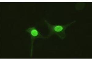 Anti-AK1 mouse monoclonal antibody (AK1) immunofluorescent staining of HeLa cells transiently transfected by pCMV6-ENTRY AK1 (RC215130). (Adenylate Kinase 1 抗体)