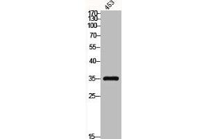 Western Blot analysis of 453 cells using C/EBP ε Polyclonal Antibody (CEBPE 抗体)