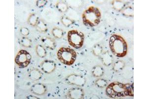 Used in DAB staining on fromalin fixed paraffin- embedded kidney tissue (KRT17 抗体  (AA 252-393))