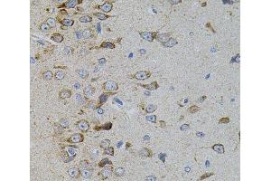 Immunohistochemistry of paraffin-embedded Rat brain using MAPK11 Polyclonal Antibody (MAPK11 抗体)