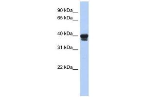 NAPE-PLD antibody used at 1 ug/ml to detect target protein. (NAPEPLD 抗体  (N-Term))