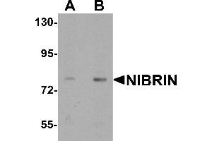Western blot analysis of NIBRIN in rat lung tissue lysate with NIBRIN antibody at (A) 1 and (B) 2 µg/mL. (Nibrin 抗体  (N-Term))