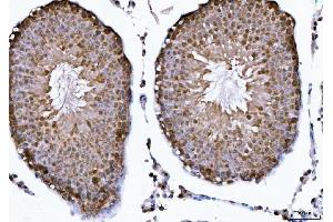 IHC analysis of CSNK2K2 using anti-CSNK2K2 antibody (ABIN7602871).