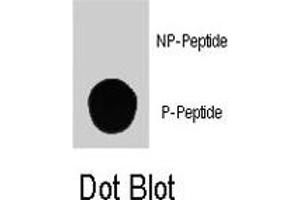 Dot blot analysis of PIK3C3 (phospho S164) polyclonal antibody  on nitrocellulose membrane. (PIK3C3 抗体  (pSer164))
