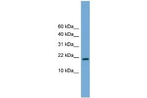 WB Suggested Anti-Cited4 Antibody Titration:  0. (CITED4 抗体  (Middle Region))