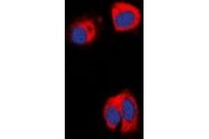 Immunofluorescent analysis of AAK1 staining in HepG2 cells. (AAK1 抗体)