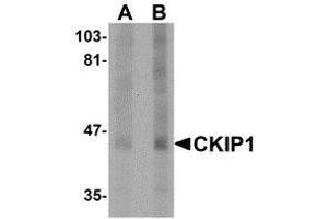 Western blot analysis of CKIP1 in human lung tissue lysate with AP30235PU-N CKIP1 antibody at (A) 1 and (B) 2 μg/ml.