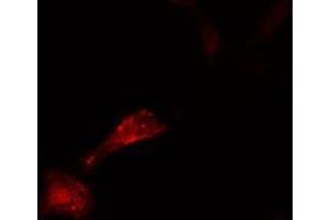 ABIN6276576 staining  HeLa cells by IF/ICC. (CDC25A 抗体  (N-Term))