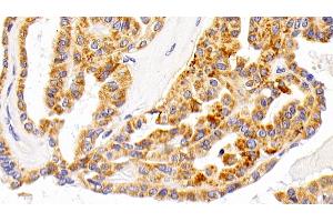 Immunohistochemistry (IHC) image for anti-Lysosomal-Associated Membrane Protein 1 (LAMP1) (AA 49-297) antibody (ABIN7439003)