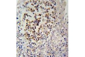 Immunohistochemistry analysis in human tonsils tissue (formalin-fixed, paraffin-embedded) using IL12RB2  Antibody (C-term), followed by peroxidase conjugation of the secondary antibody and DAB staining. (IL12RB2 抗体  (C-Term))
