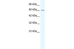 WB Suggested Anti-ZNF21 Antibody Titration:  0. (ZNF182 抗体  (Middle Region))